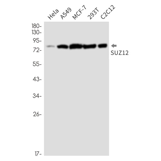 Polycomb Protein SUZ12 Rabbit Monoclonal Antibody