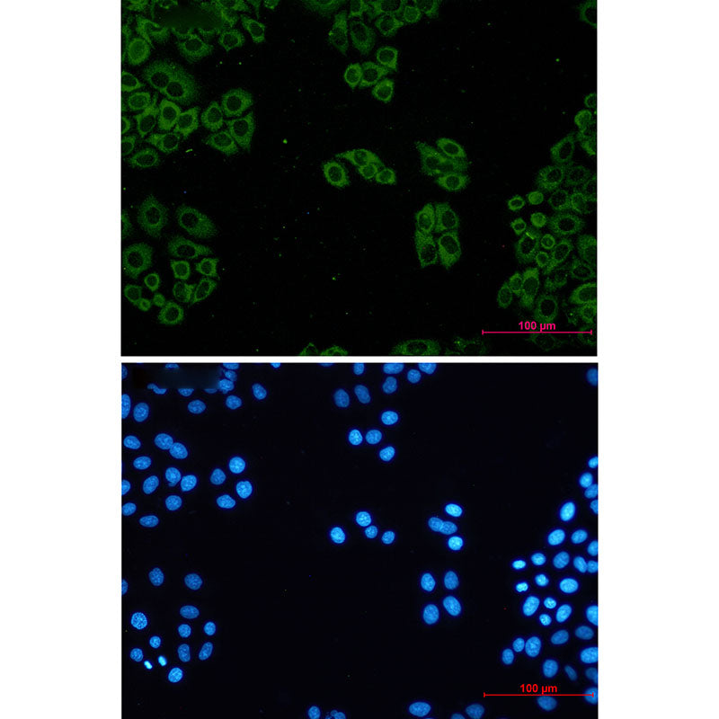 TCP 1 alpha Rabbit Monoclonal Antibody