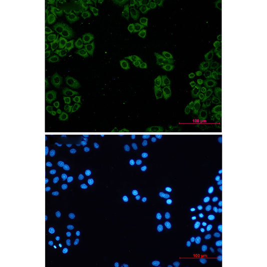 TCP 1 alpha Rabbit Monoclonal Antibody