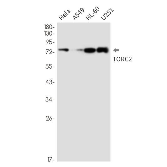 CREB Regulated Transcription Coactivator 2 Rabbit Monoclonal Antibody