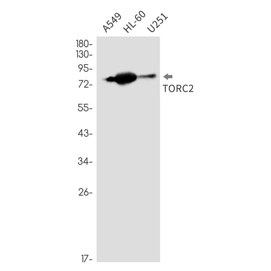 CREB Regulated Transcription Coactivator 2 Rabbit Monoclonal Antibody