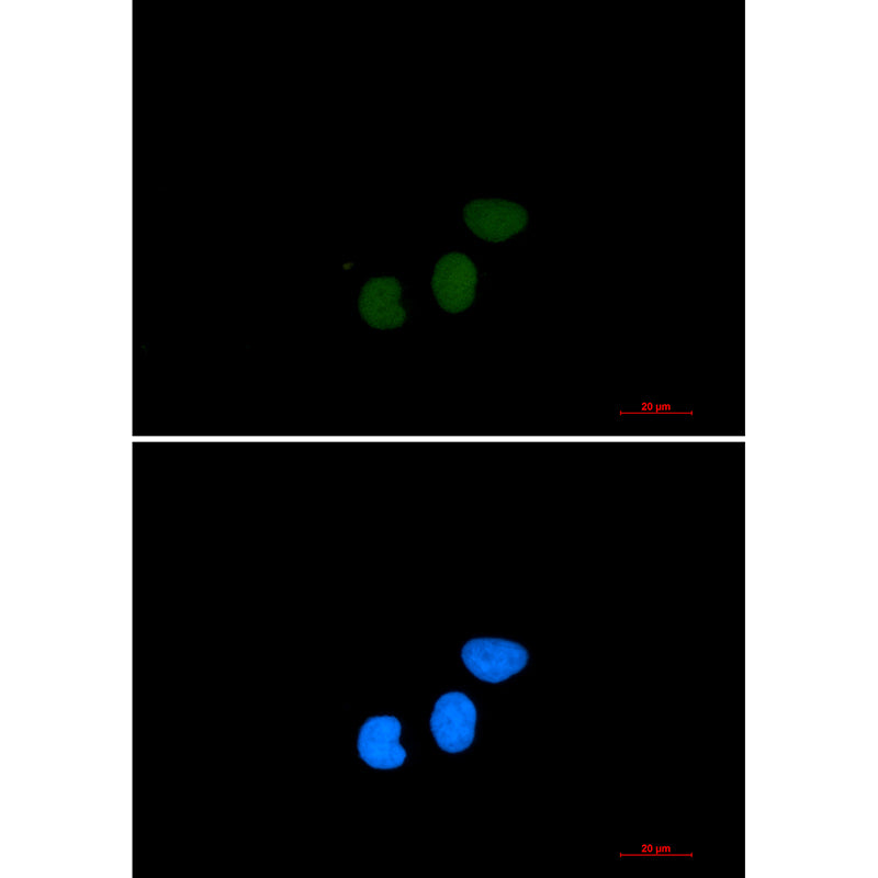 TPX2 Rabbit Monoclonal Antibody