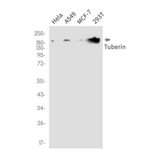 Tuberin Rabbit Monoclonal Antibody