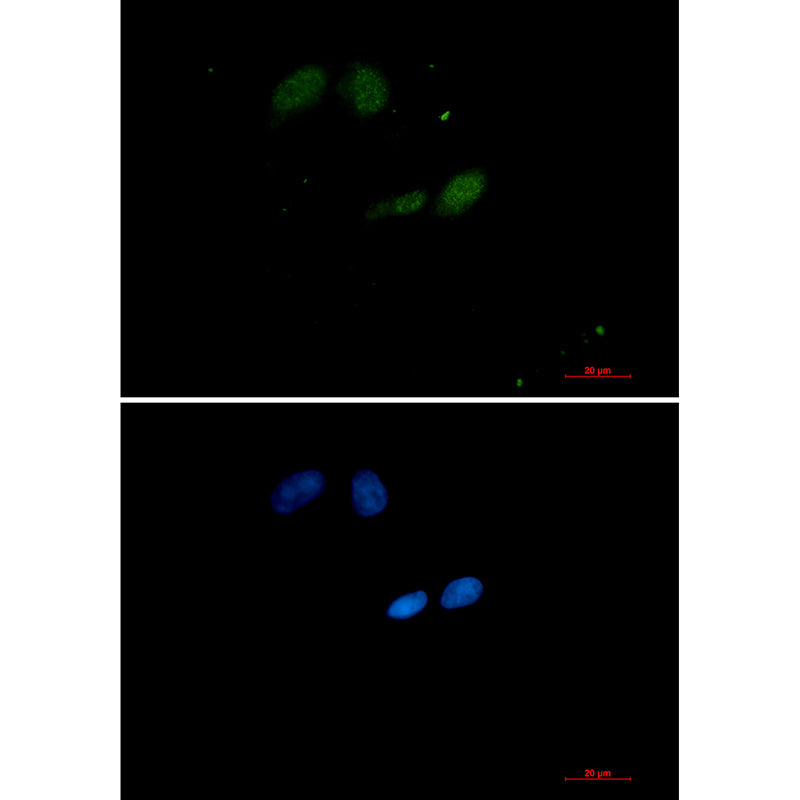 SUMO Conjugating Enzyme UBC9 Rabbit Monoclonal Antibody