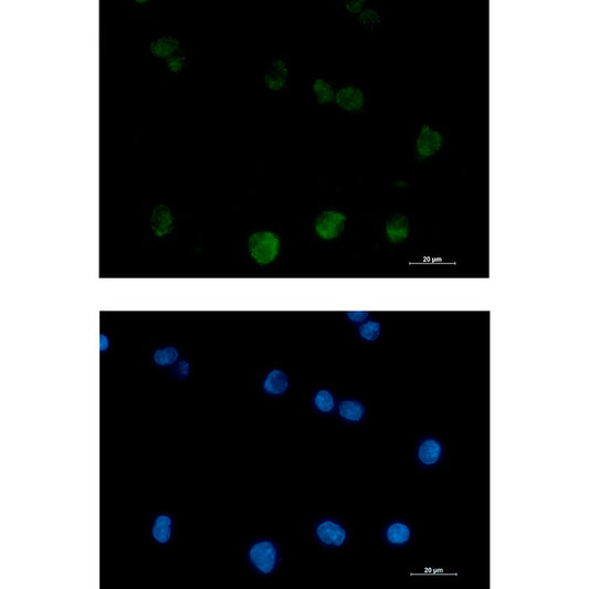 PKC beta 2 Rabbit Monoclonal Antibody