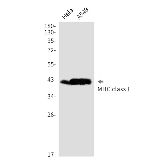 MHC Class I Rabbit Monoclonal Antibody