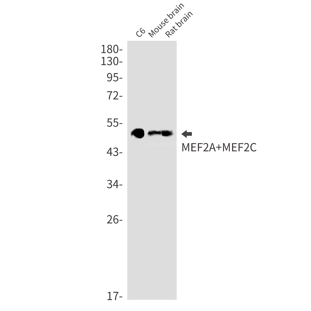 MEF2A/MEF2C Rabbit Monoclonal Antibody