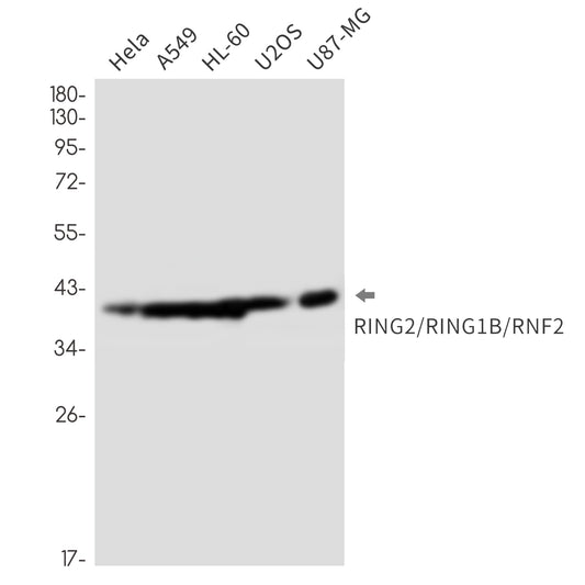 RING2 Rabbit Monoclonal Antibody