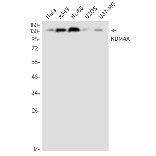 KDM4A Rabbit Monoclonal Antibody