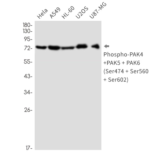 Phospho-PAK4/5/6 (Ser474/Ser560/Ser602) Rabbit Monoclonal Antibody