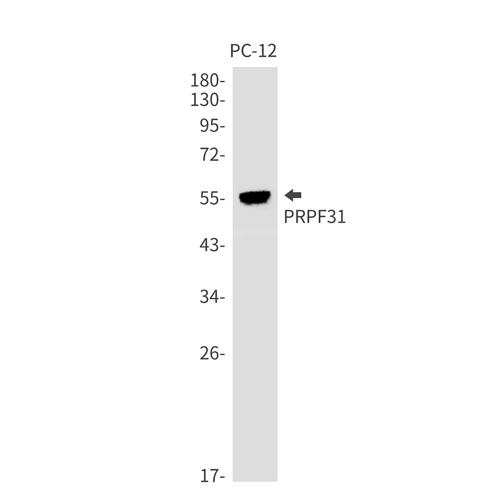PRPF31 Rabbit Monoclonal Antibody