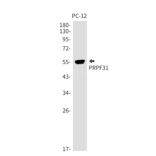 PRPF31 Rabbit Monoclonal Antibody