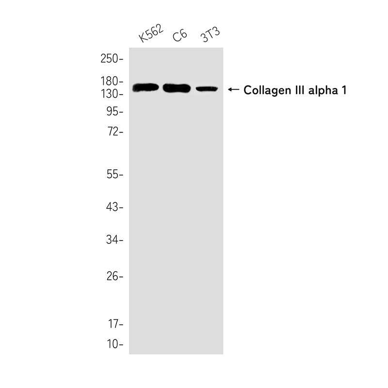 Collagen III alpha 1 Rabbit Monoclonal Antibody
