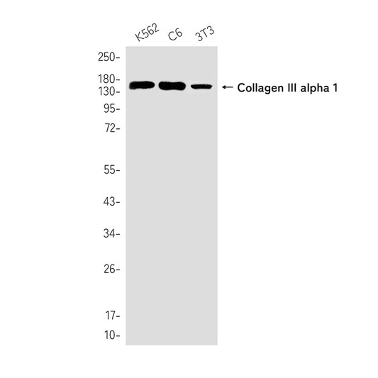 Collagen III alpha 1 Rabbit Monoclonal Antibody
