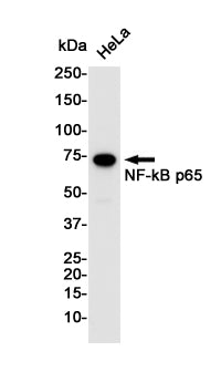 NF-KB p65 Rabbit Monoclonal Antibody