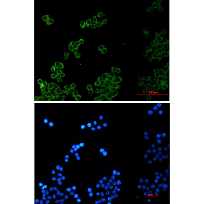 Phospholipase A2 Activator Protein Rabbit Monoclonal Antibody