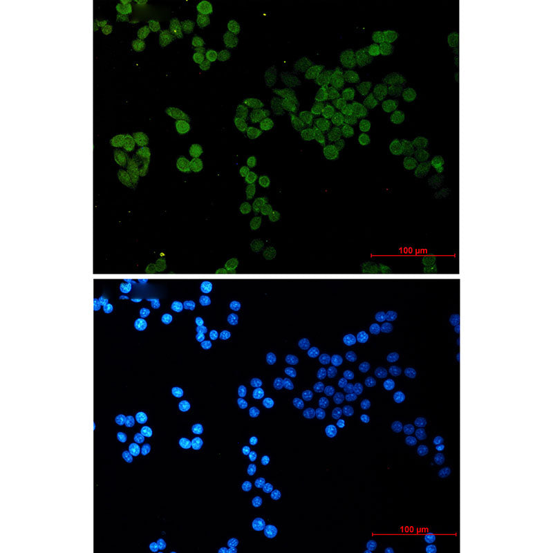 CRCP Rabbit Monoclonal Antibody