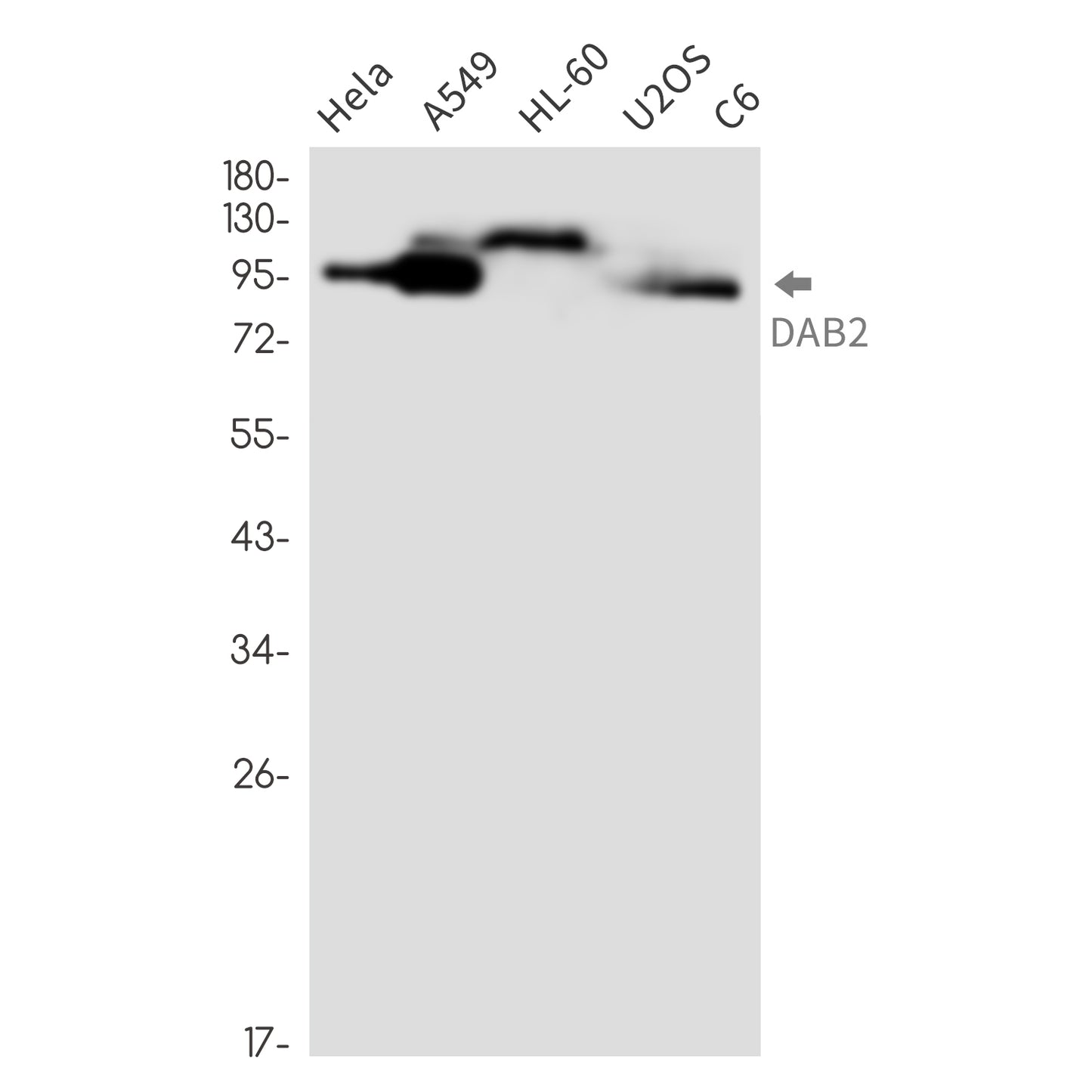 DAB2 Rabbit Monoclonal Antibody