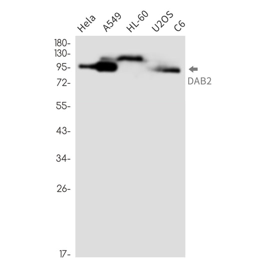 DAB2 Rabbit Monoclonal Antibody