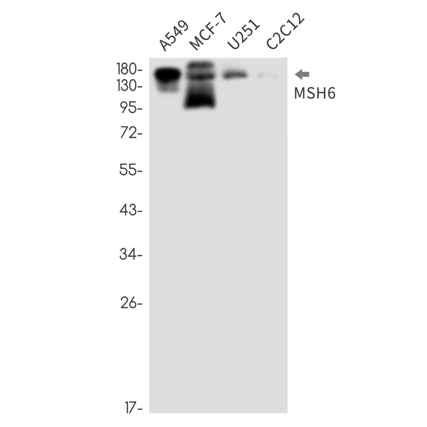 MSH6 Rabbit Monoclonal Antibody