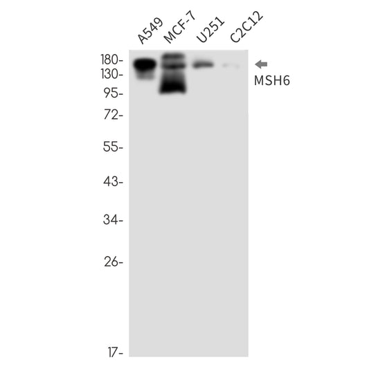 MSH6 Rabbit Monoclonal Antibody