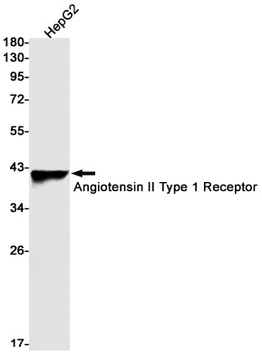 Angiotensin II Type 1 Receptor Rabbit Monoclonal Antibody