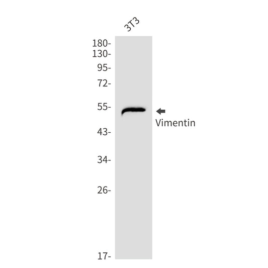 Vimentin Rabbit Monoclonal Antibody