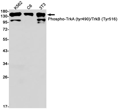 Phospho-TrkA/B (Tyr490/Tyr516) Rabbit Monoclonal Antibody