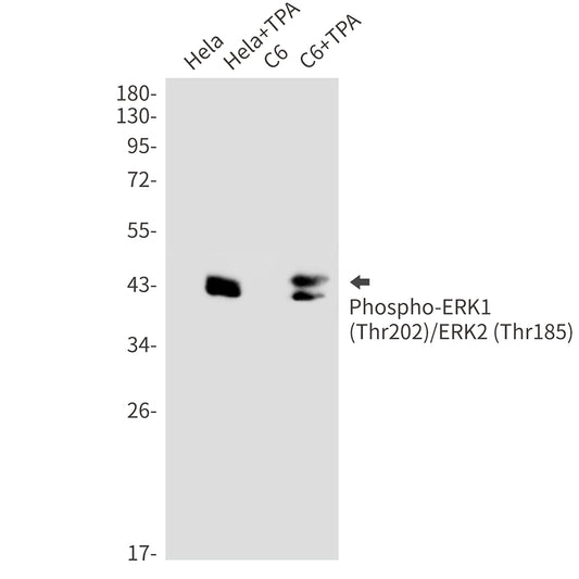 Phospho-ERK1/2 (Thr202/Thr185) Rabbit Monoclonal Antibody