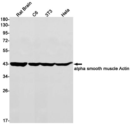 alpha Smooth Muscle Actin Rabbit Monoclonal Antibody