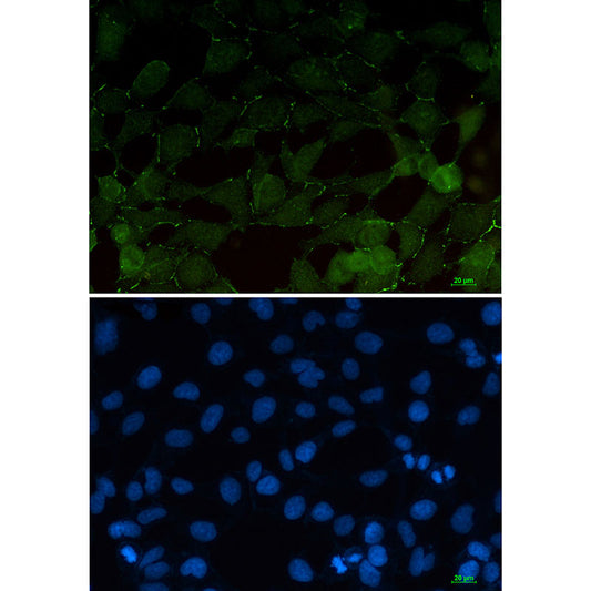 beta Catenin Rabbit Monoclonal Antibody