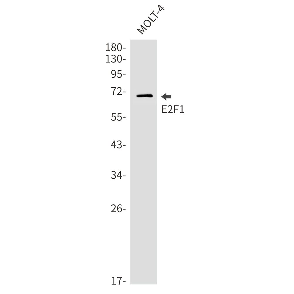 E2F1 Rabbit Monoclonal Antibody