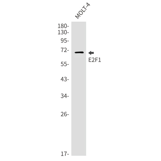 E2F1 Rabbit Monoclonal Antibody