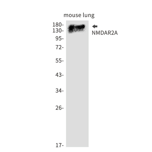 NMDAR2A Rabbit Monoclonal Antibody