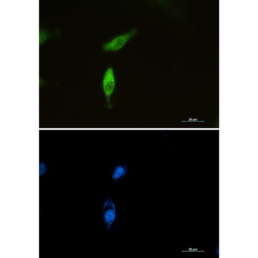 SQSTM1/p62 Rabbit Monoclonal Antibody