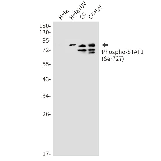 Phospho-STAT1 (Ser727) Rabbit Monoclonal Antibody