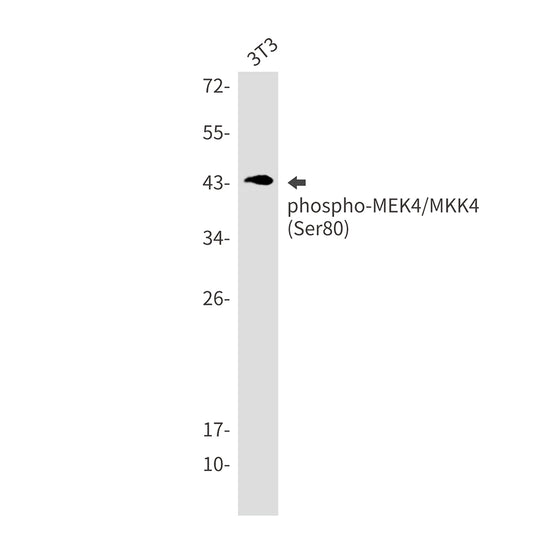 Phospho-MEK4 (Ser80) Rabbit Monoclonal Antibody