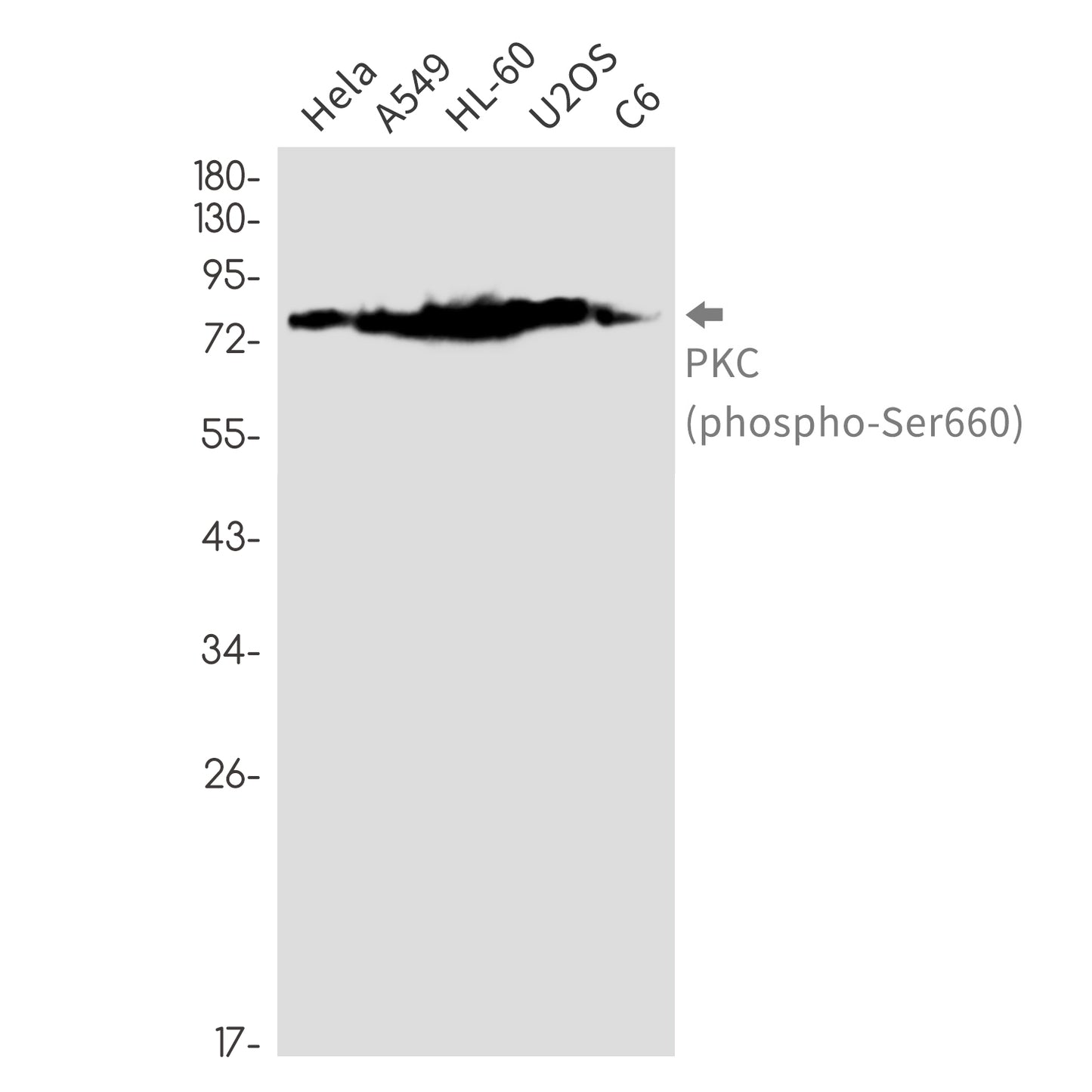 Phospho-PKC (Ser660) Rabbit Monoclonal Antibody