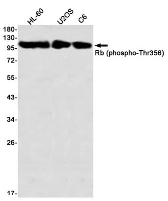 Phospho-Rb (Thr356) Rabbit Monoclonal Antibody