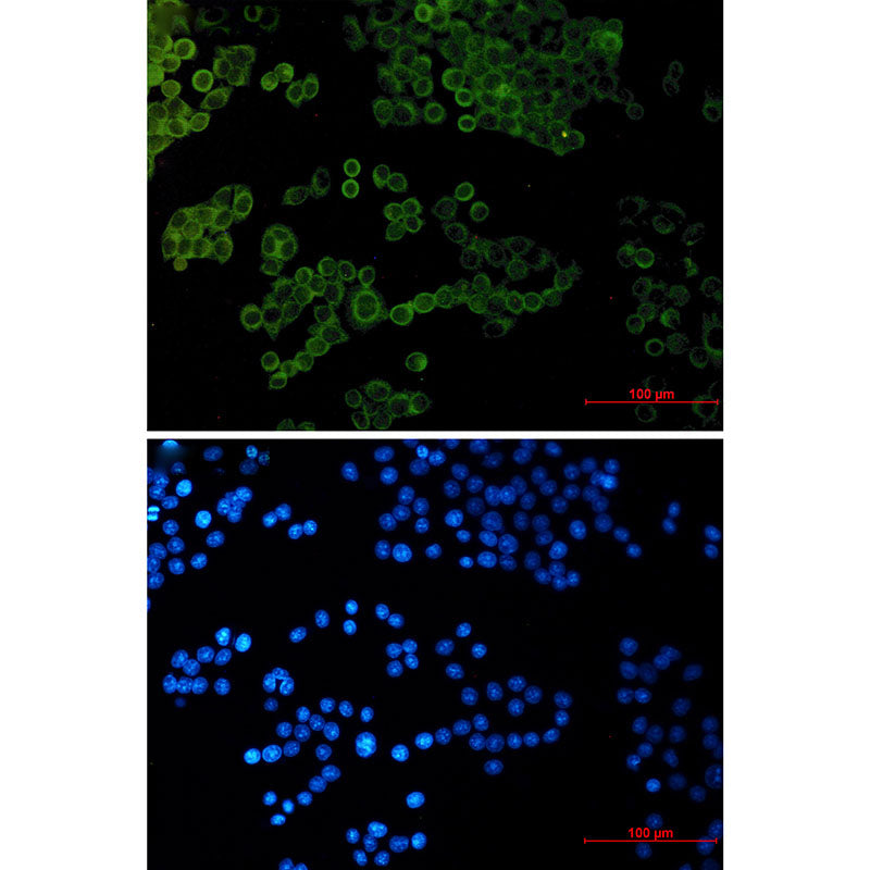 Collagen I alpha 1 Rabbit Monoclonal Antibody