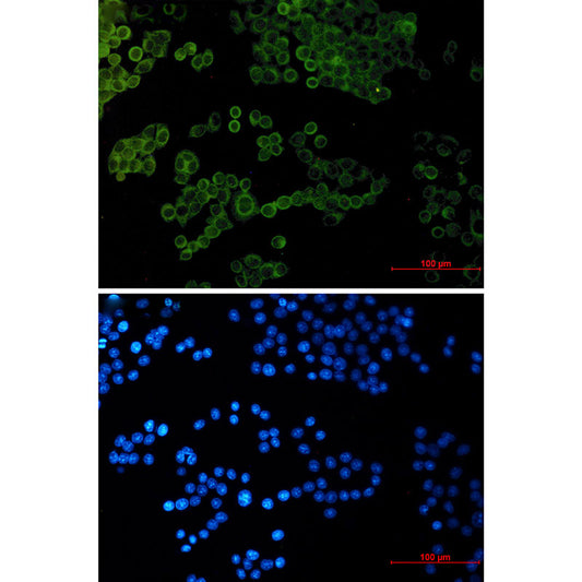 Collagen I alpha 1 Rabbit Monoclonal Antibody