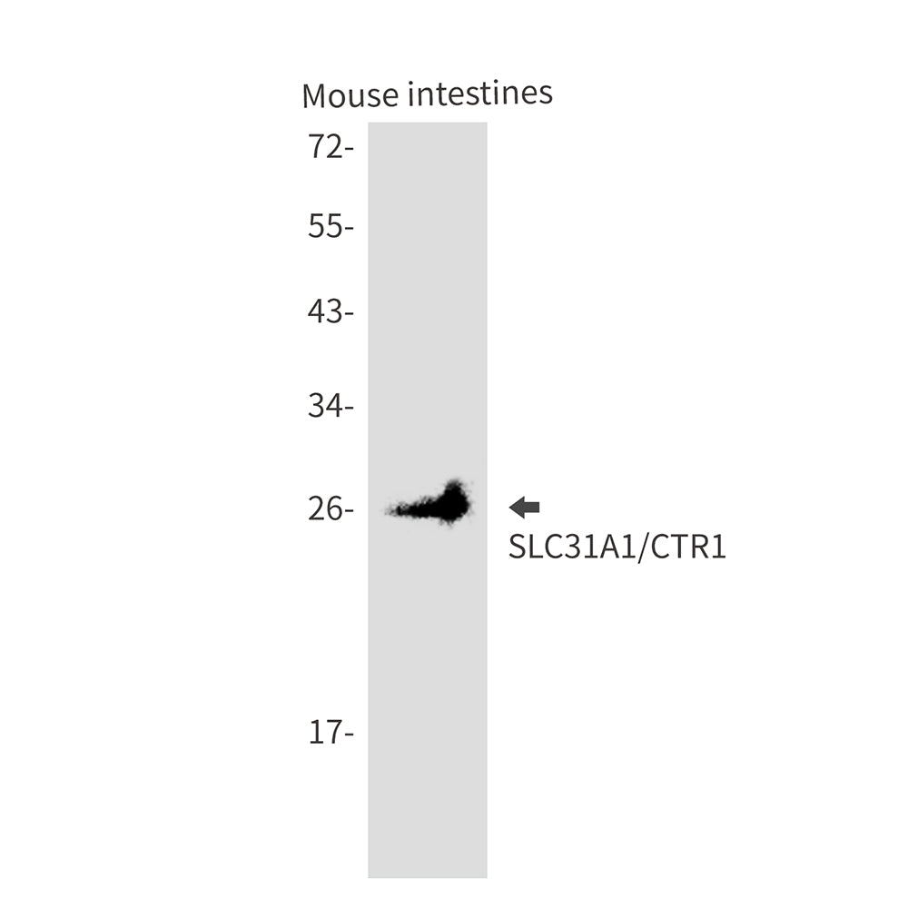 SLC31A1 Rabbit Monoclonal Antibody