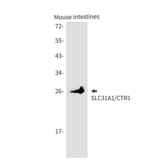 SLC31A1 Rabbit Monoclonal Antibody