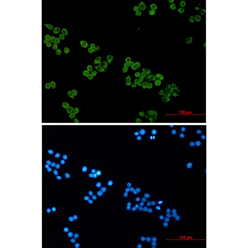 SNAP25 Rabbit Monoclonal Antibody