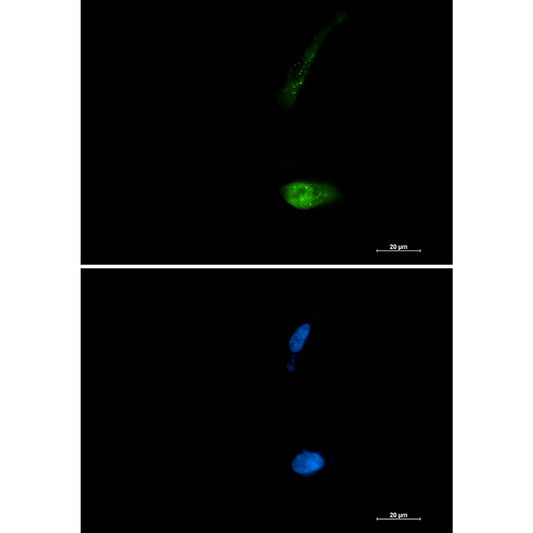 SQSTM1/p62 Rabbit Monoclonal Antibody