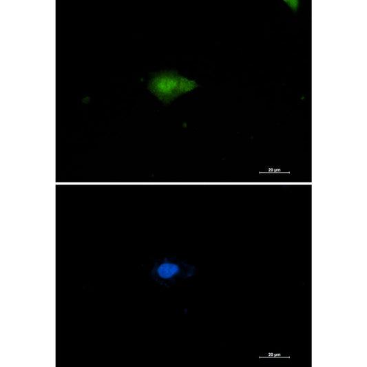 Nampt Rabbit Monoclonal Antibody