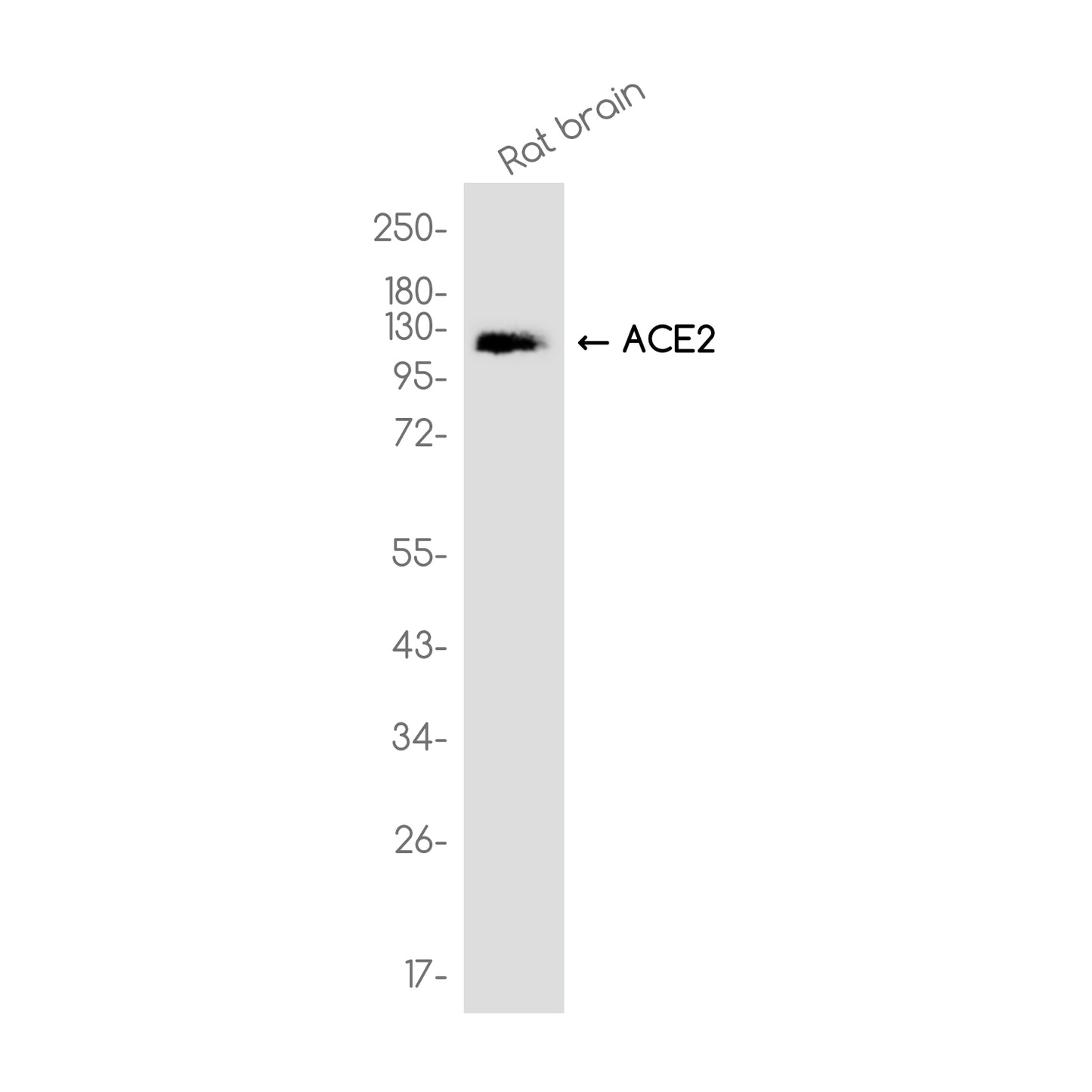 ACE2 Rabbit Monoclonal Antibody