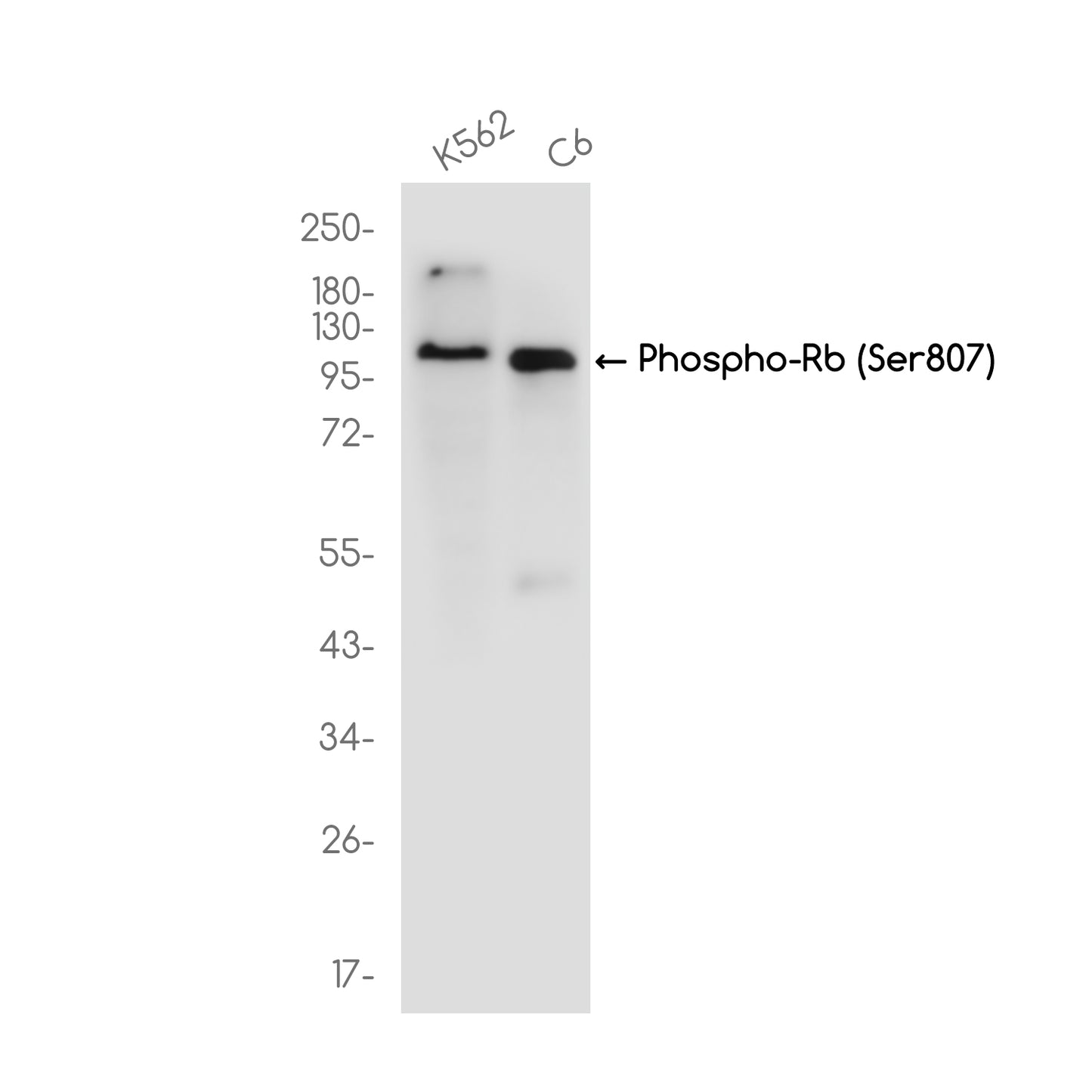 Phospho-Rb (Ser807) Rabbit Monoclonal Antibody