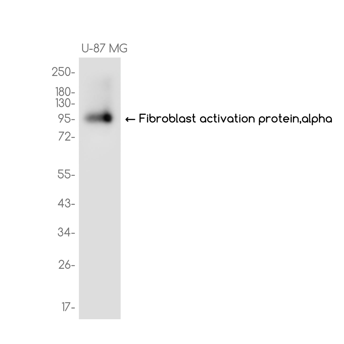 Fibroblast activation protein,alpha Rabbit Monoclonal Antibody