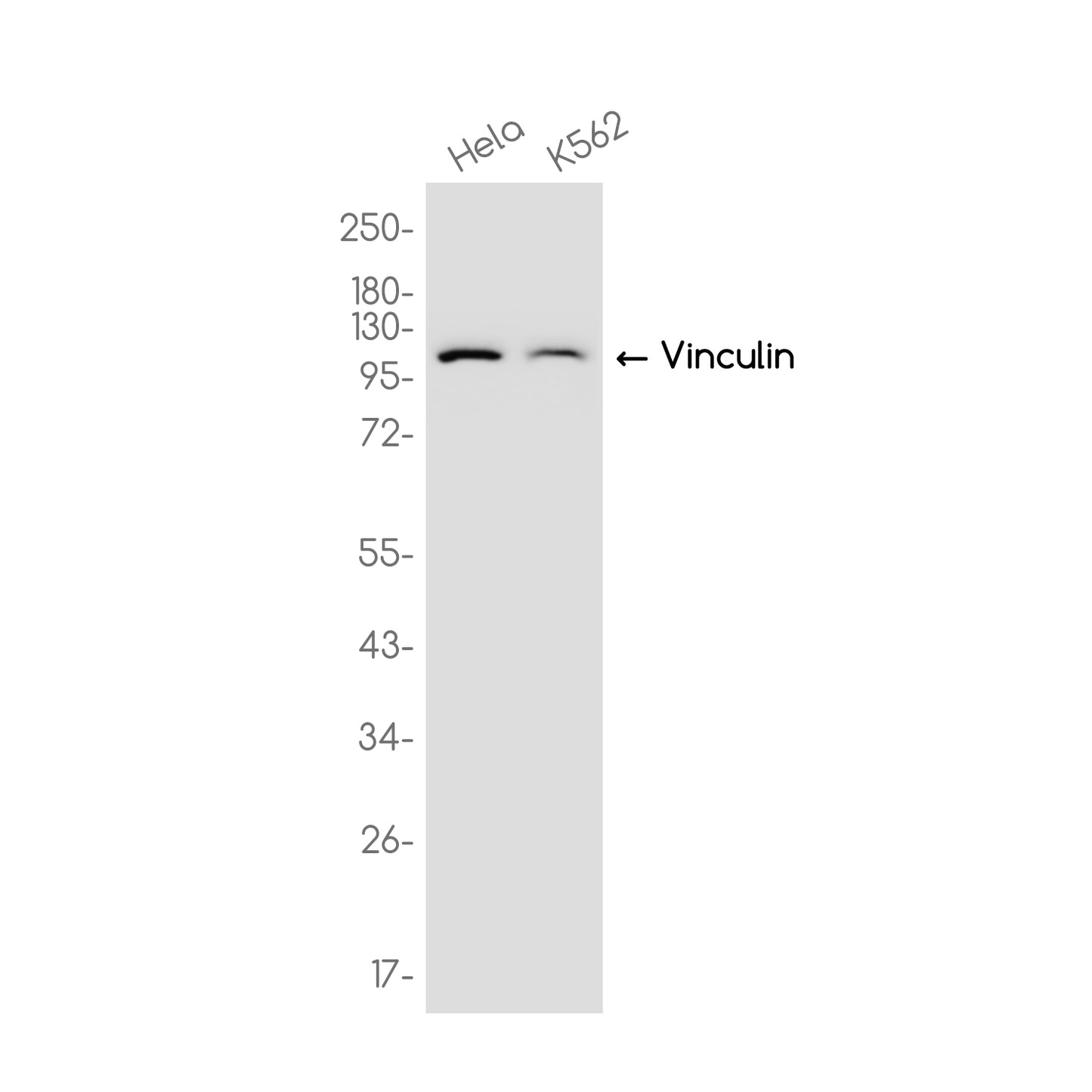 Vinculin Rabbit Monoclonal Antibody